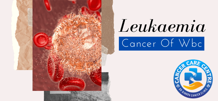 What Is Leukaemia? Are You At Risk? Which Are The Most Common Types?