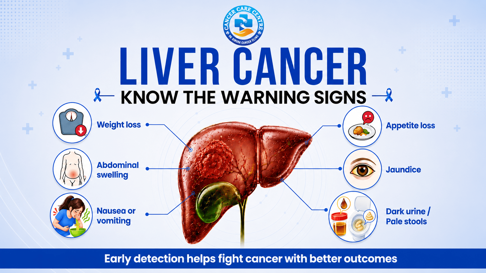 Liver Cancer: Symptoms, Diagnosis and Treatment Options
