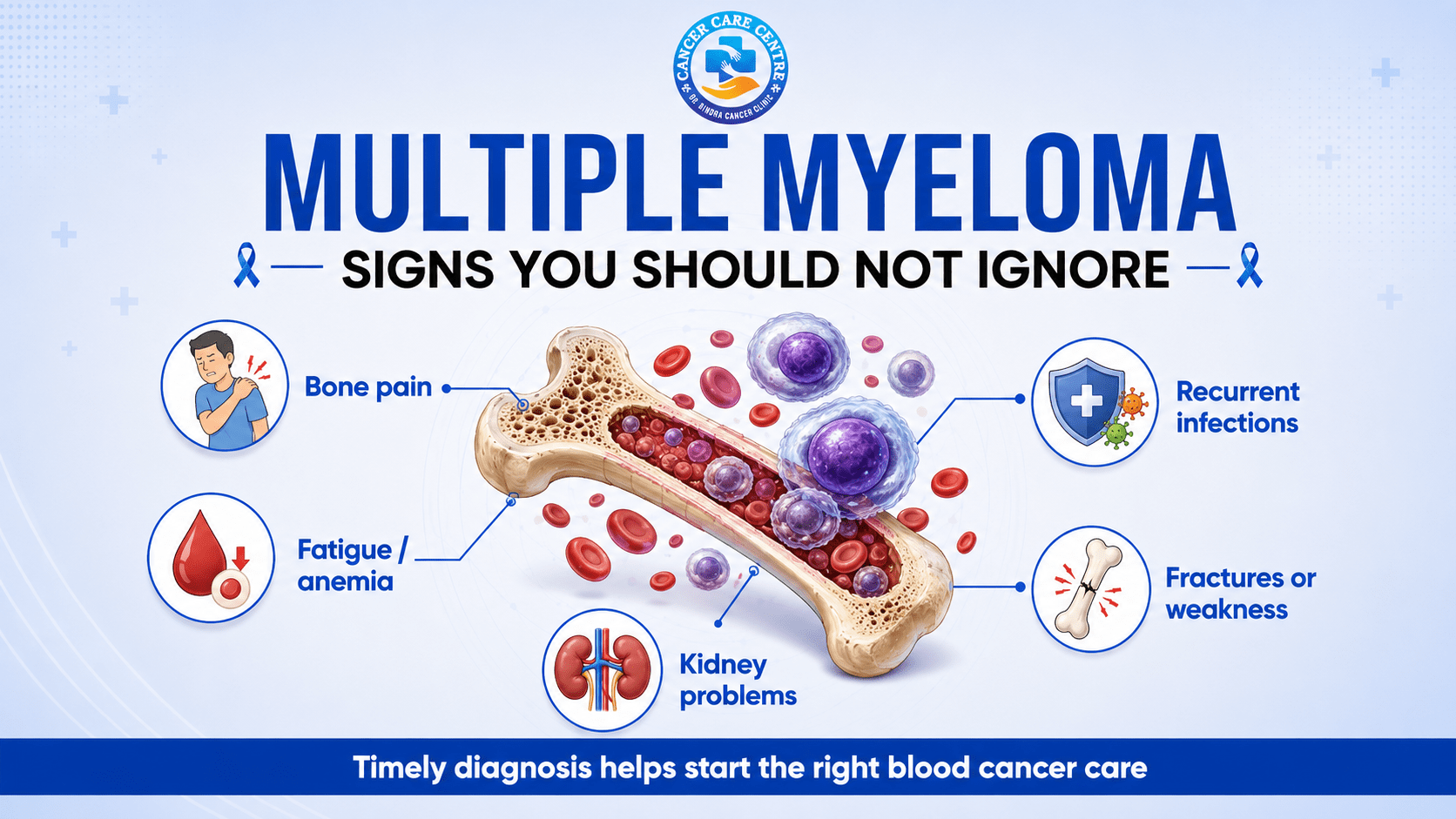 Multiple Myeloma: Symptoms, Diagnosis and Treatment