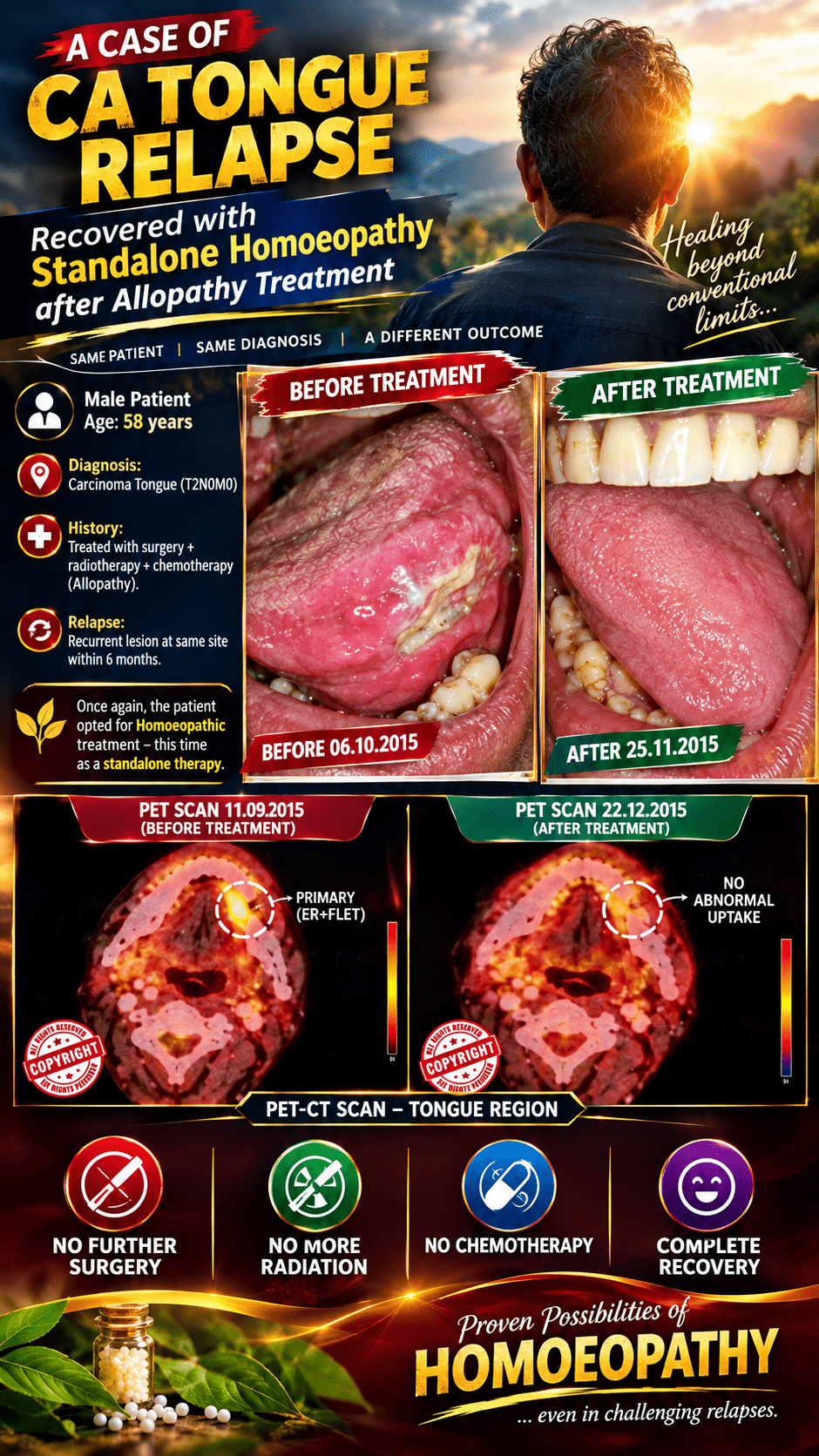 CA Tongue Success Story