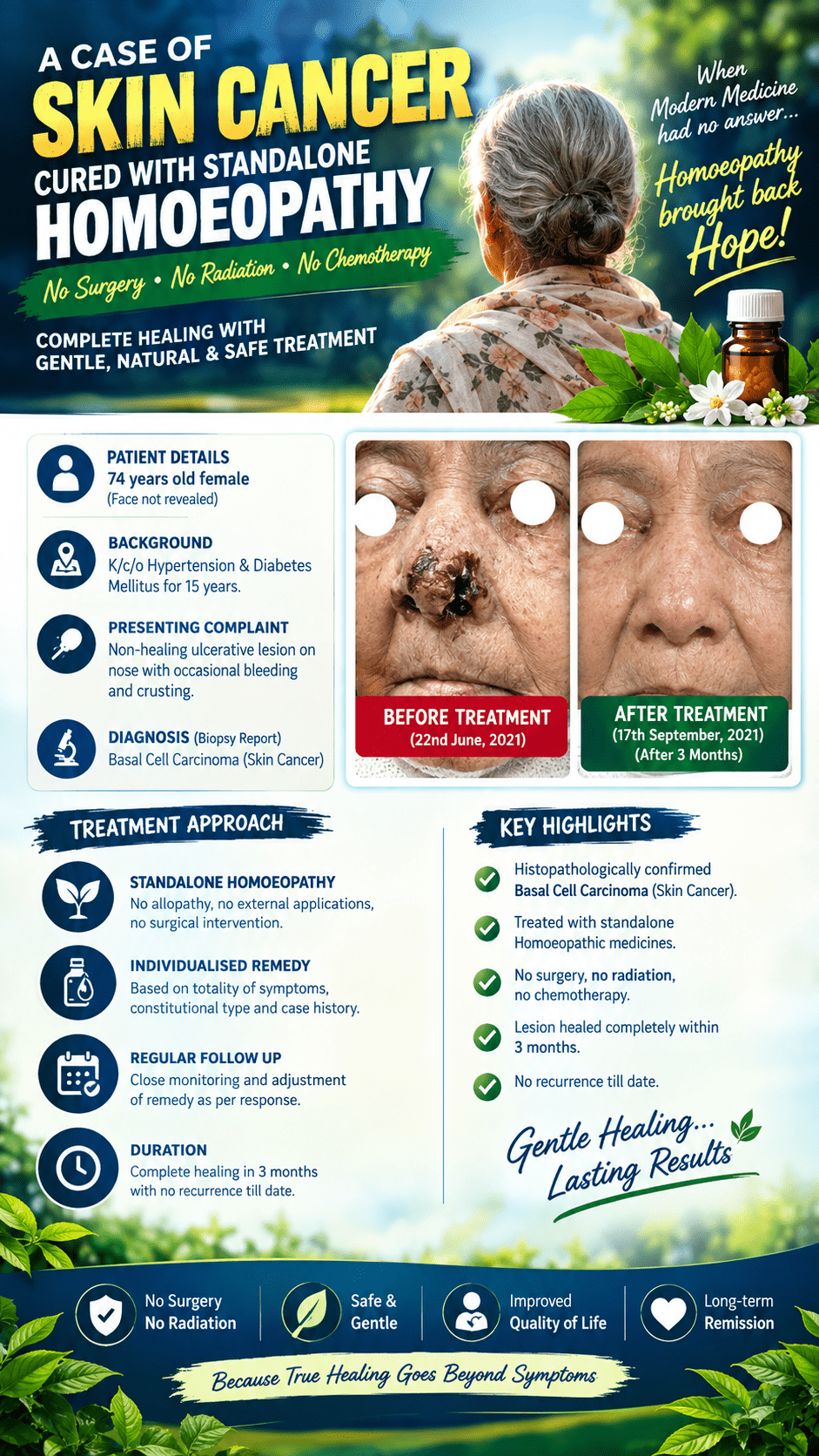 Skin Cancer Success Story